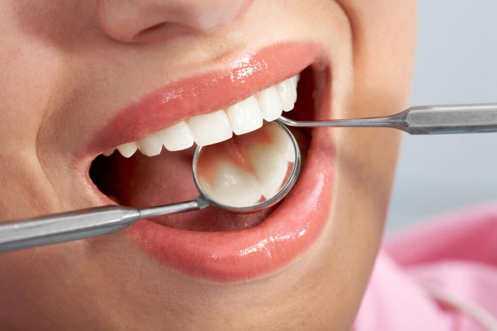 patient being examined for a tooth filling