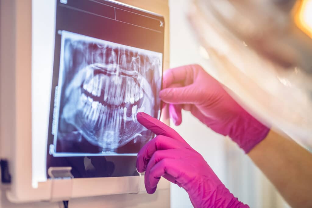 Dentist looking at a patient's X-rays to prevent dental emergencies