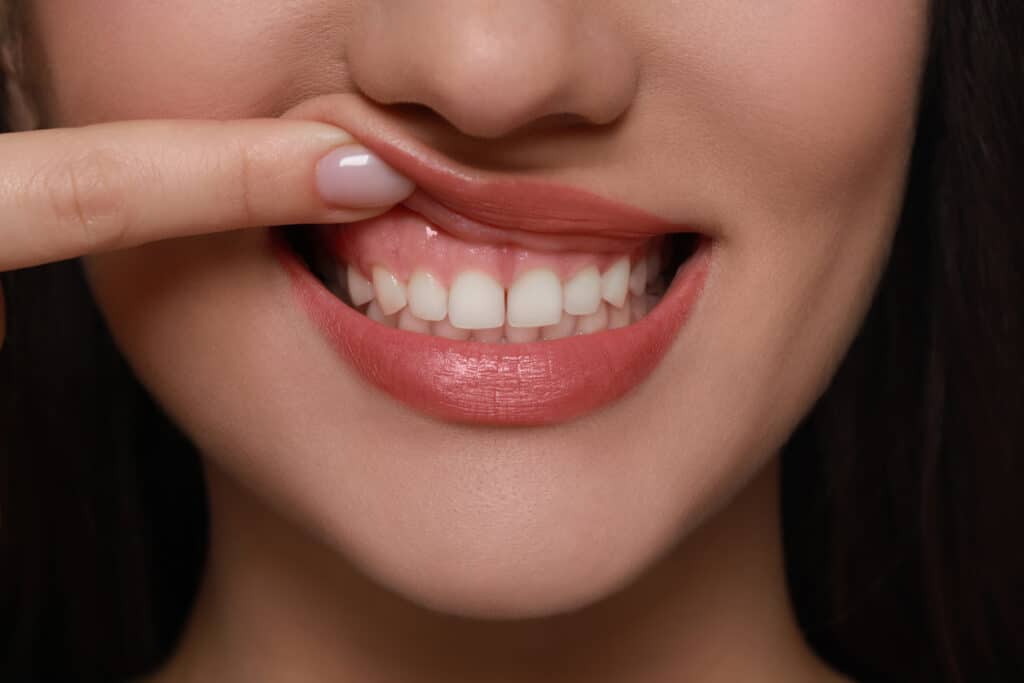 Dental patient smiling, showing their healthy gums